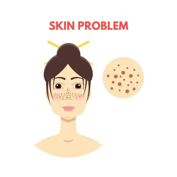 Woman with skin problem — Stock Vector