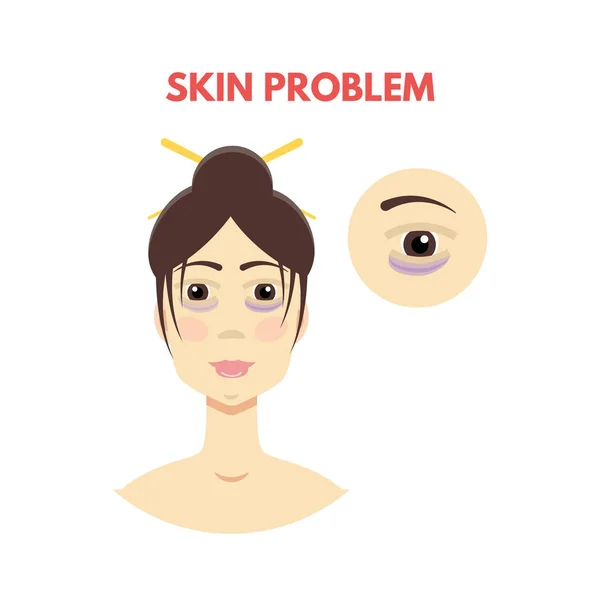 Γυναίκα με πρόβλημα του δέρματος — Διανυσματικό Αρχείο