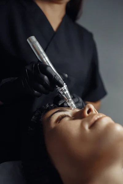 El cosmetólogo hace el procedimiento para limpiar la piel con la herramienta de acero de los puntos negros y el acné en el centro de cosmetología. —  Fotos de Stock