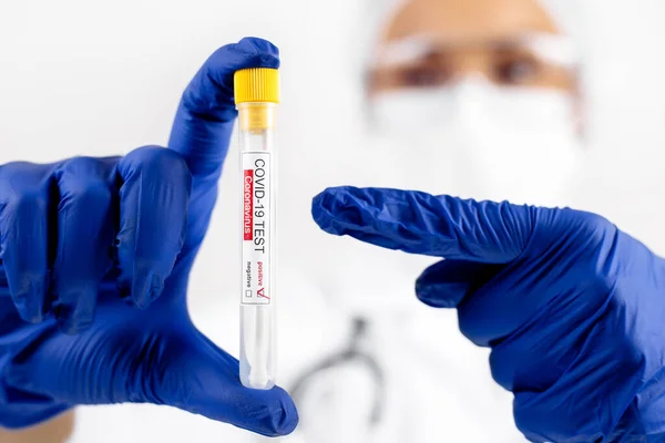 Scientist doctor pointing on positive test tube sample for coronavirus. Coronavirus outbreak and pandemic concept.