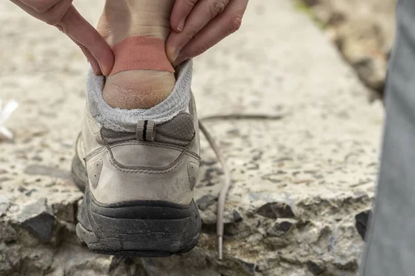 Pedestrian Tourist Glues Patch His Foot Close Photo — Stock Photo, Image