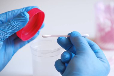 Koronavirüs teşhisi için test sistemi