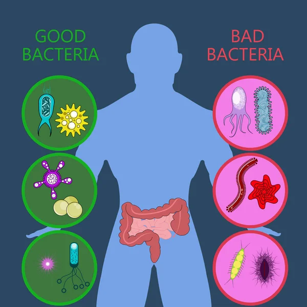 Medicinsk infografik. Intestinal flora tarm sundhed vektor – Stock-vektor