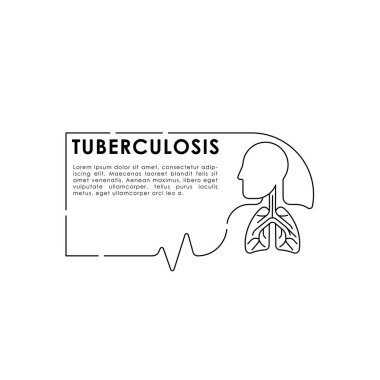 Tüberküloz - Tıbbi Akciğerler Vektör İllüstrasyonu