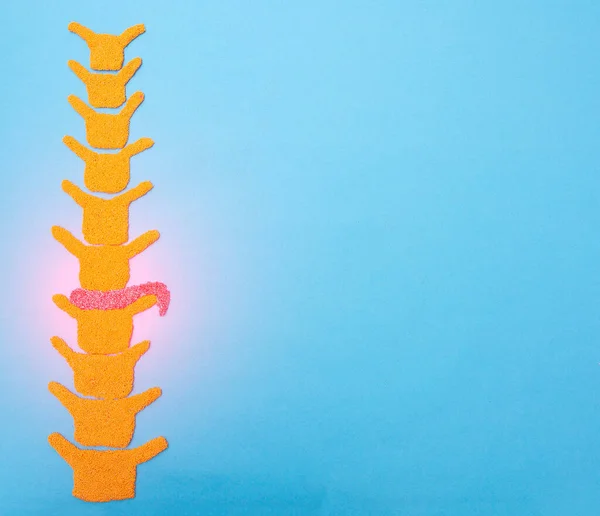 Spine on a blue background. The concept of intervertebral hernia — Stock Image Spine on a blue background. The concept of intervertebral hernia Stock Picture