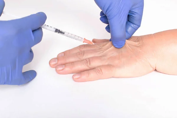 A plastic surgeon doctor does an injection of a beauty injection into the hands of an elderly woman. Hand wrinkle rejuvenation concept, close-up. Lipofilling — Stock Photo, Image