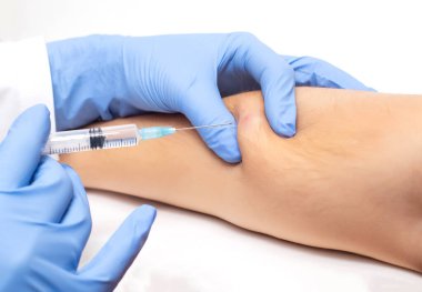 Doktor hastadan deri biyopsisi almak için bir şırınga kullanır. Kötü huylu deri altı lezyonları, yakın plan.