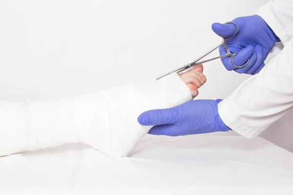 The doctor removes the plaster cast with medical scissors on a white background. Fibular ankle fracture, copy space — Stock Photo, Image