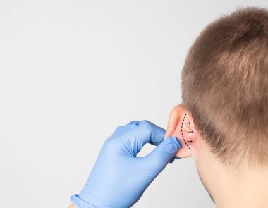 A plastic surgeon doctor examines a male patient s ear for an otoplasty operation. The concept of removing deafness, copy space clipart