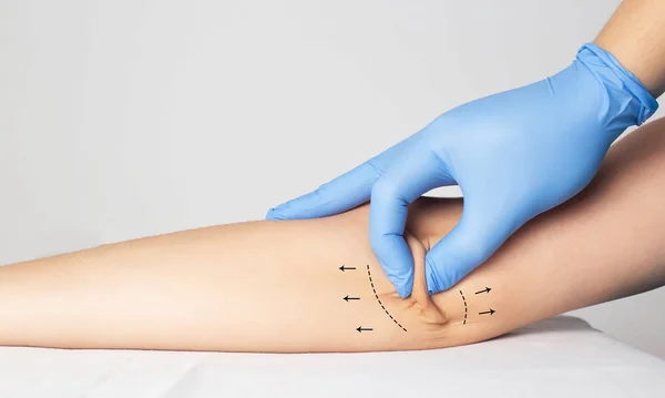 Doctor plastic surgeon examines the skin on the patient's elbow. The concept of plastic surgery and skin tightening on the hands, copy space — 스톡 사진