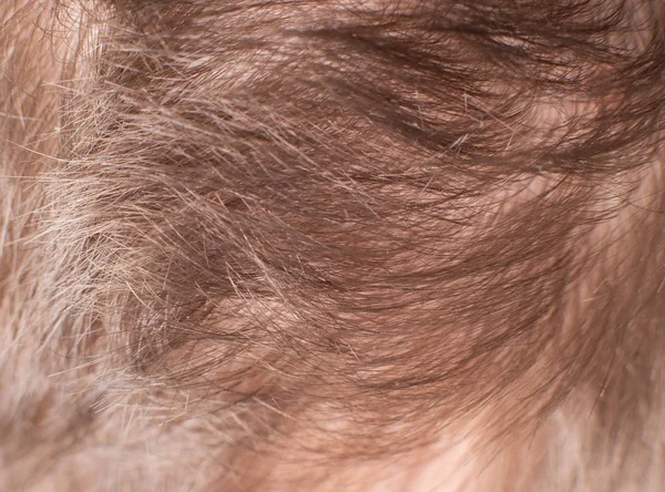 Braune Haare auf menschlichem Kopf, Nahaufnahme, Hintergrund, Dermatologie — Stockfoto