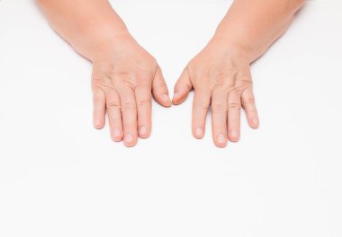 Yaşlı bir kadının ellerinde kırışıklıklar olan kuru bir cilt, beyaz arka plan, izole edilmiş. Kan damarlarının kırılganlığı, vitamin eksikliği.