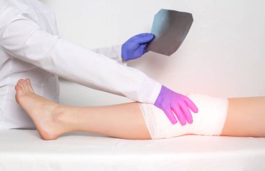 Bir ortopedi doktoru bir hastanın dizinin röntgen fotoğrafını tutuyor. Dizdeki ve dizdeki hastalıklar ve yaralanmalar, burkulma, alçıtaşı bandajı.