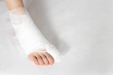 Bandaged big toe with foot on white background. Concept of fracture of the foot and thumb, close-up clipart