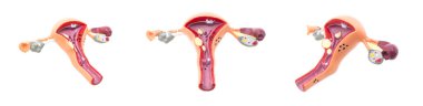 Mock female reproductive system on a white background, isolate. Fallopian tubes and ovaries clipart