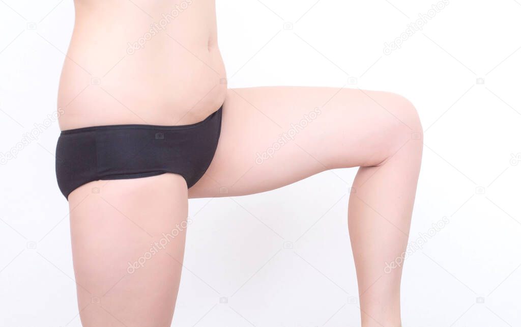 Distressed female legs with saggy skin on the thighs and cellulite on a white background, isolate. The concept of skin tone and proper nutrition, body care, plastic surgery
