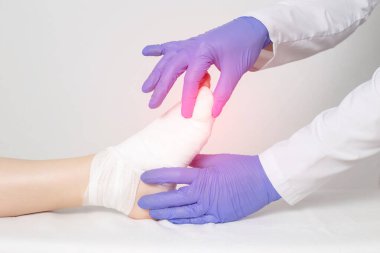 Doktor ayak parmağındaki küçük parmağı muayene eder. Ayak parmağına alçıtaşı sürme kavramı, ayak kırığı ve yer değiştirme.