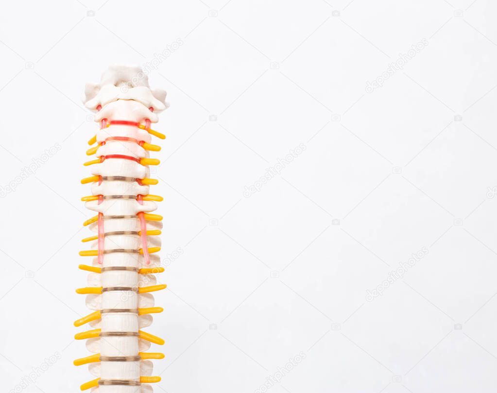 Cervical and thoracic spine on a white background. Intervertebral hernia of the cervical spine, rupture of the fibrous ring. Osteochondrosis