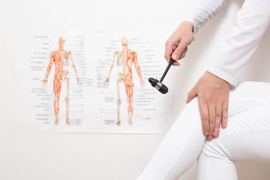 Nöropatolog doktor nörolojik bir molotof kokteylinin yardımıyla uyluk sinirinin iletim sinirinin diz refleksini kontrol ediyor. Patoloji ve tedavi edilen nörolojik hastalıklar