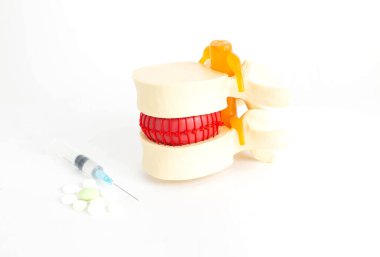 Omurga, tablet ve şırıngaların yanında. Osteokondroz ve omurgalar arası fıtıkların tedavi konsepti. İlaç tedavisinin de yardımıyla. Chondroguartors ve kortikosteroidler