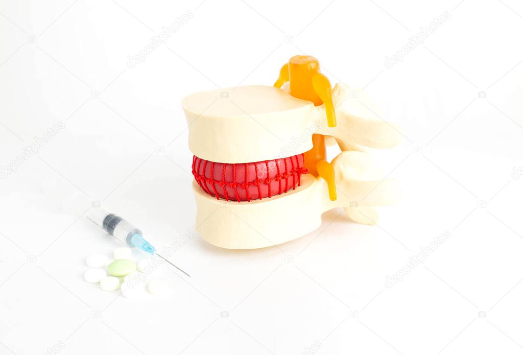 The spine is next to which are the tablets and syringe. The concept of treatment of osteochondrosis and intervertebral hernias with the help of drug therapy. Chondroprotectors and corticosteroids to