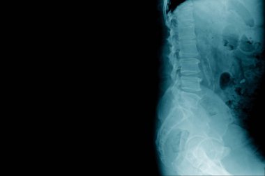 insan omurgasının yan görüntüsü