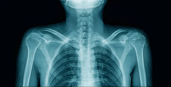 사람의 윗부분에 있는 엑스선 — 스톡 사진