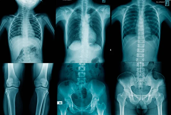 Collection human x-ray image — 스톡 사진