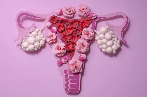 Konzept Polyzystisches Ovar Syndrom Pcos Papierkunst Bewusstsein Für Pcos Bild — Stockfoto