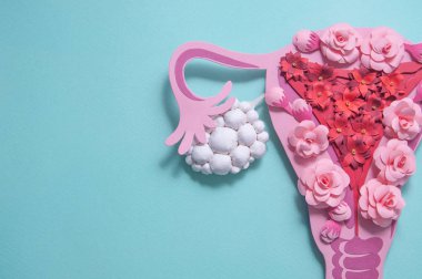 Polisistik yumurtalık sendromu, Pcos. Kağıt sanatı, Pcos 'un farkındalığı, kadın üreme sisteminin imajı.