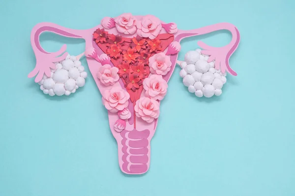 Concepto síndrome de ovario poliquístico, SOP. Espacio de copia, sistema reproductivo de las mujeres —  Fotos de Stock