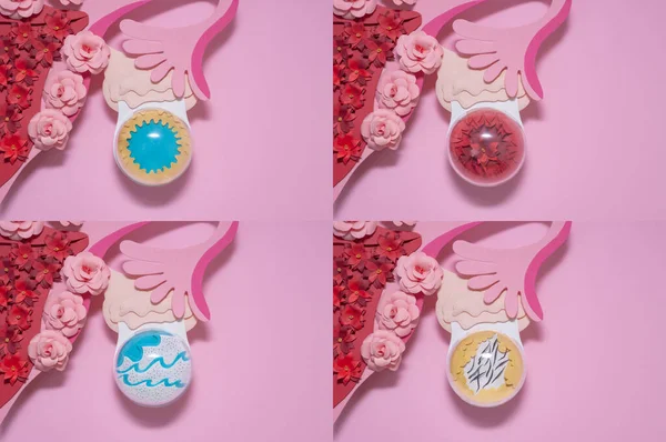 O conceito criativo colagem diferentes tipos de cistos ovarianos . — Fotografia de Stock
