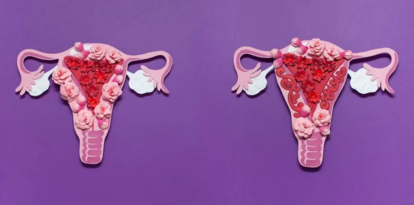 O sistema reprodutivo das mulheres. O conceito de endometriose do útero . — Fotografia de Stock