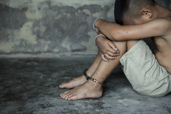 Child was a victim of human trafficking, foot tied up with shackle in emotional stress — Stock Photo, Image