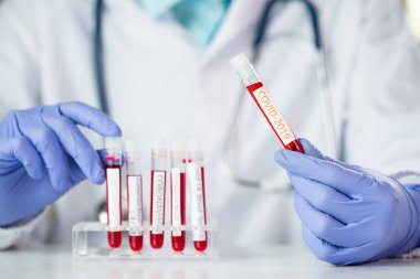Doktor 2019 nCoV analizi için test tüpünü kanla tutuyor. covid-19 virüsü, Coronavirus kan testi.