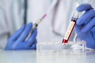 Doktor 2019 nCoV analizi için test tüpünü kanla tutuyor. covid-19 virüsü, Coronavirus kan testi konsepti, şırınga ve mavi eldivenli aşı. 