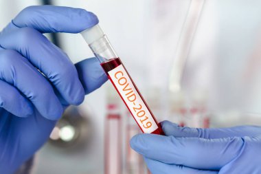 Doktor 2019 nCoV analizi için test tüpünü kanla tutuyor. covid-19 virüsü, Coronavirus kan testi.