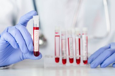Doktor 2019 nCoV analizi için test tüpünü kanla tutuyor. covid-19 virüsü, Coronavirus kan testi konsepti, şırınga ve mavi eldivenli aşı. 