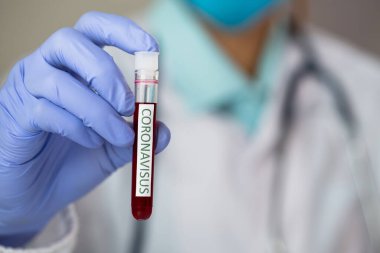 Doktor 2019 nCoV analizi için test tüpünü kanla tutuyor. covid-19 virüsü, Coronavirus kan testi konsepti, şırınga ve mavi eldivenli aşı. 