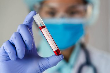 Doktor, COVID-19 testi için kan örneği içeren test tüpü tutuyor. Yeni Coronavirus 2019.. 