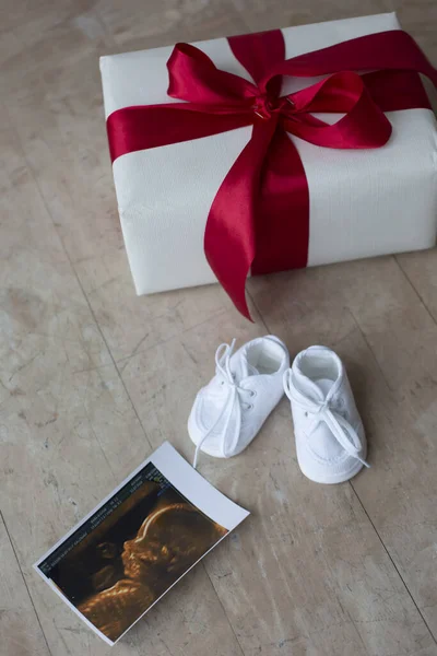 Scatola regalo a ultrasuoni per scarpe da bambino, concetto di gravidanza tanto atteso — Foto Stock