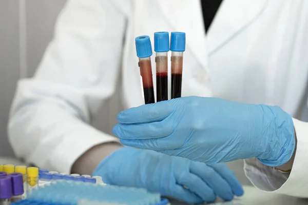 Δοκιμαστικοί σωλήνες αίματος σε χέρια γιατρών στο εργαστήριο της κλινικής. Δείγματα ανάλυσης. Κοντινό πλάνο — Φωτογραφία Αρχείου