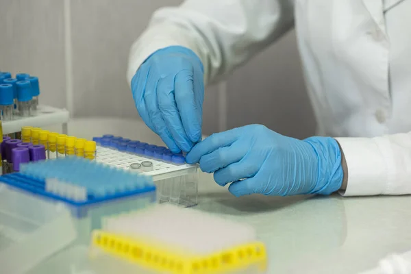Lab læge sætte reagensglas med væsker i rack. Diagnosticeringsbiokemisk analyse - Stock-foto