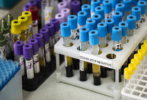 Titolari con campioni di tubo contaminati da coronavirus con risultati negativi — Foto Stock