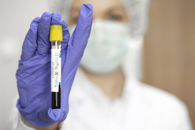 Mikrobiyolog üzerinde Covid-19 yazan test tüpünü tutuyor, pozitif koronavirüs testi sonucu.