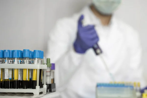 Technik laboratoryjny bada krew w laboratorium. Skup się na próbkach krwi w stojaku — Zdjęcie stockowe