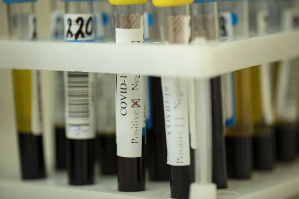 Portabicchiere con provette da laboratorio di campioni biologici, test coronavirus positivo — Foto Stock