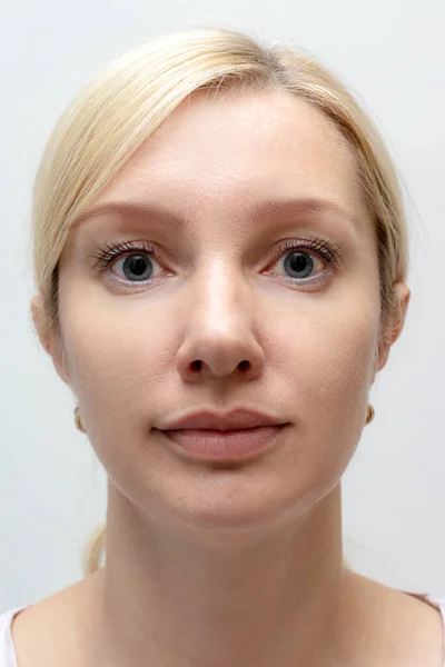 Woman Face Perfect Retouched Skin Concept Rejuvenating Cosmetological Procedures Biorevitalization — Stock Photo, Image