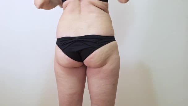 Kvinna skaka sin feta rumpa med celluliter, visar hängande fett på nära håll — Stockvideo