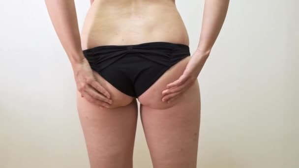 Woman shacking her fat buttock with cellulite, showing hanging fat close up — Stock Video
